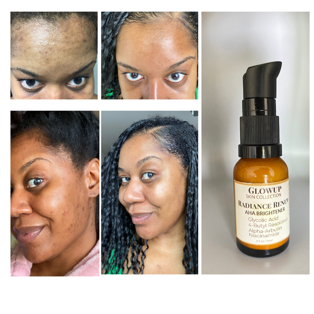 Radiance Renew AHA Brightener - The ultimate solution for dark spots, uneven skin tone, and dull texture. - glowup-skin-collection